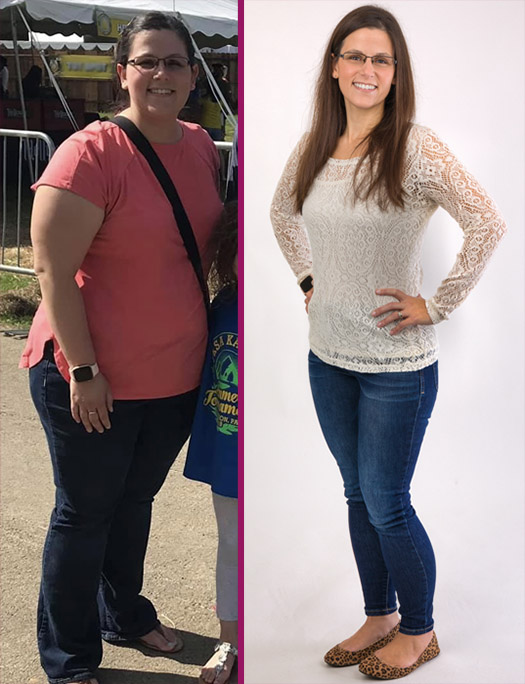 Amie's Gastric Sleeve Before and After