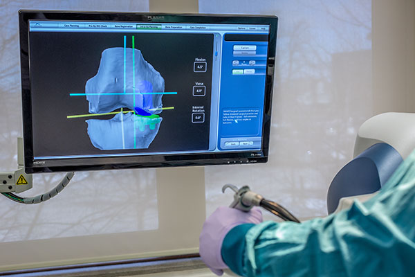 Robotic Assisted Surgery